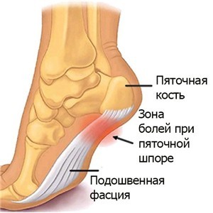 Что такое апоневроз - где он находится и как его лечить если воспалился