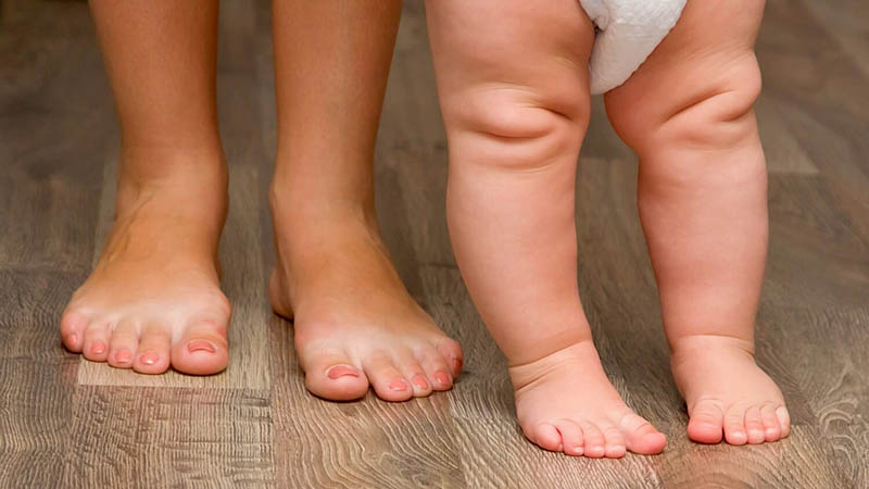 Как лечат незрелость тазобедренных суставов у новорожденных