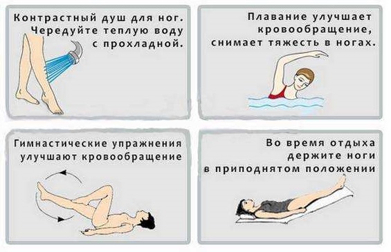 профилактика варикоза на ногах