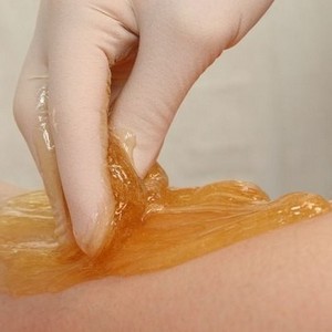 Что делать если после шугаринга в зоне бикини появились гнойнички