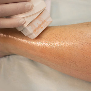 Как пользоваться пастой для шугаринга в картриджах