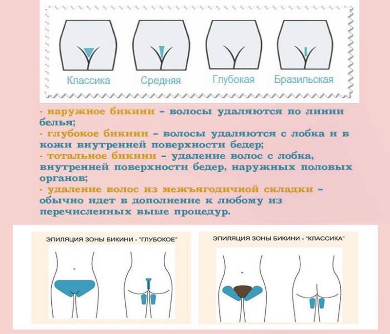 Как делается шугаринг зоны бикини