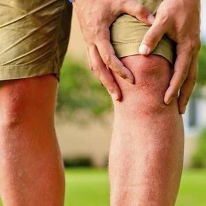 Что такое коксартроз (гонартроз) коленного сустава и как его лечить