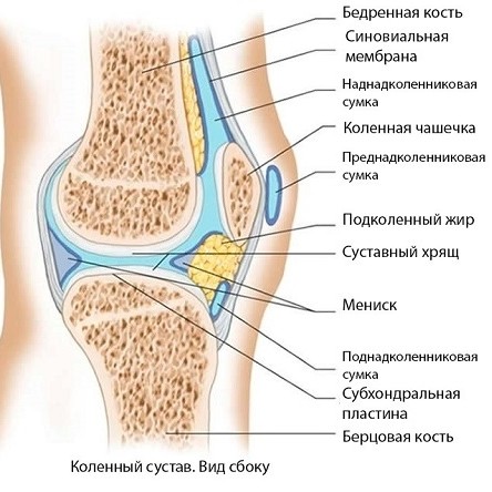Как лечить препателлярный бурсит коленного сустава