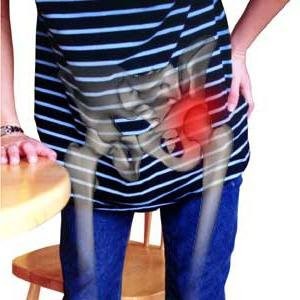 Как лечить синовит тазобедренного сустава