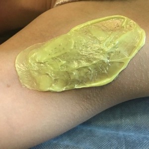 Полимерная депиляция Скинс (Skins) - основные принципы и отзывы