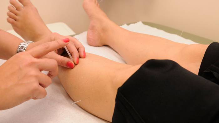 Стоит ли пробовать иглоукалывание для похудения: отзывы об эффективности