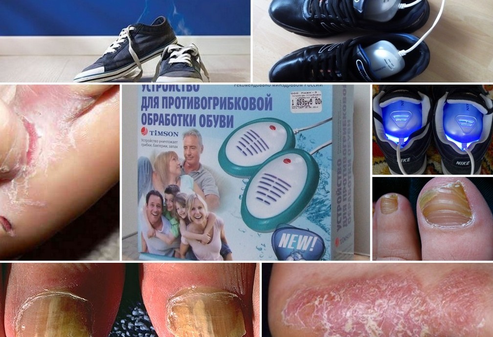Устройство для противогрибковой обработки обуви Timson в каждый дом