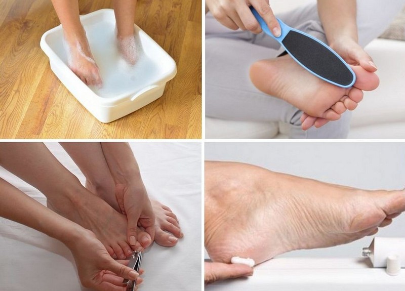 Мазь Тридерм от грибка ногтей: показания к применению