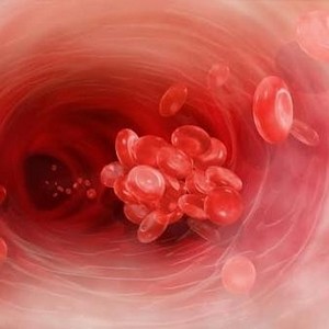 Что такое тромбоз нижних конечностей и как с ним бороться?