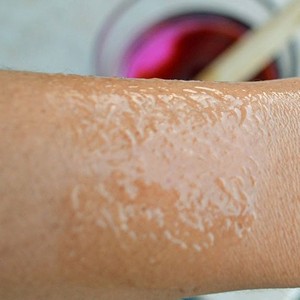 Как избавиться от волос с помощью йода и нашатыря