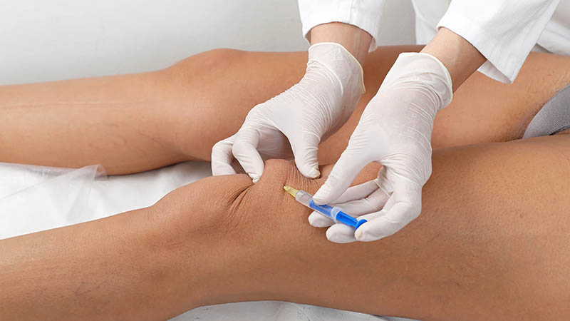 Как лечат артроз коленного сустава