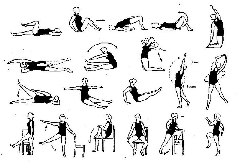 Комплекс упражнений при варикозе нижних конечностей и малого таза