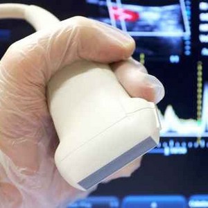 Что такое ультразвуковая допплерография