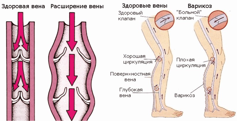 Крем Венорм: инструкция по применению и отзывы