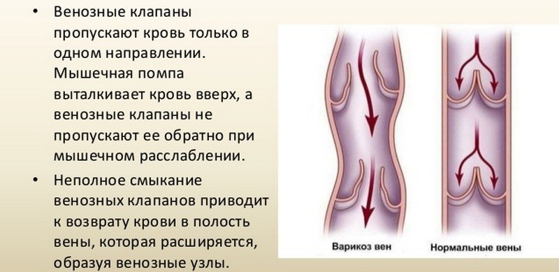 Клапаны вен нижних конечностей и их патологии
