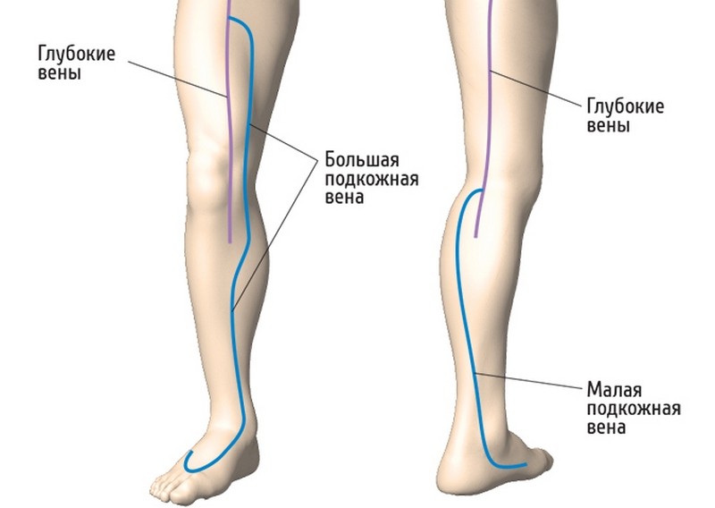 Клапаны вен нижних конечностей и их патологии