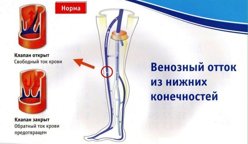 Какие витамины пьют при варикозе